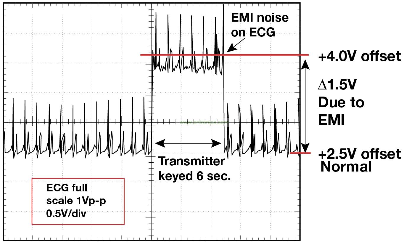 圖 1    1.5 英尺以外的發(fā)射器（f = 470 MHz, P= 0.5W）開啟和關閉時 ECG 診斷設備的心臟檢查結果