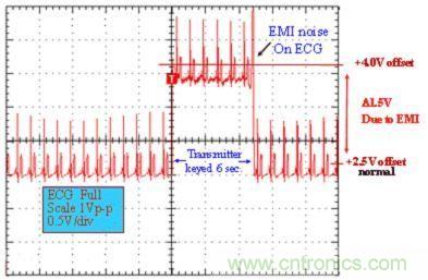 圖 1：醫(yī)用 ECG 測(cè)量設(shè)備的性能